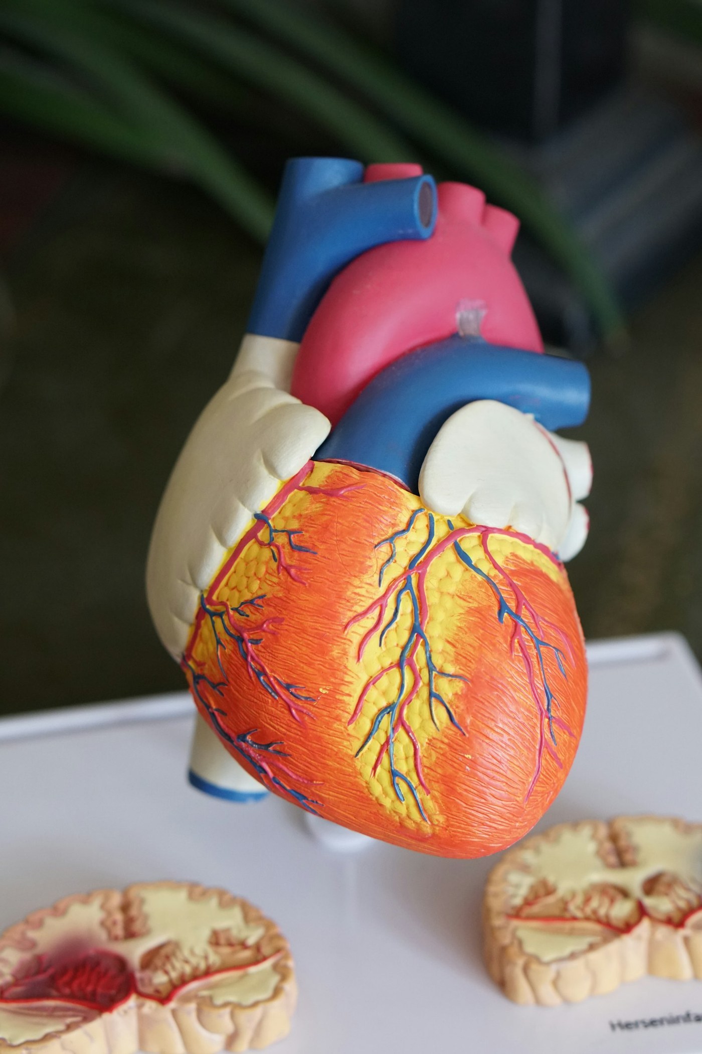 Close-up of a coloured anatomical heart model showing major vessels and ventricular surface detail